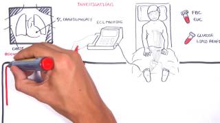 Acute Coronary Syndrome DETAILED Overview MI STEMI NSTEMI [upl. by Rauscher]