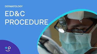 EDampC Procedure Overview Dermatology [upl. by Nydnarb509]