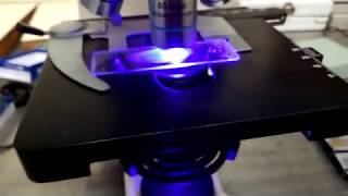 Mycobacterium under Fluorescence Microscope [upl. by Isied]