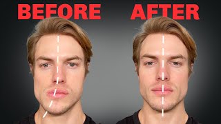 How to Fix Asymmetrical Jaw amp Face FOREVER [upl. by Crellen]