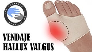 Vendaje para juanetes o hallux valgus [upl. by Agneta]