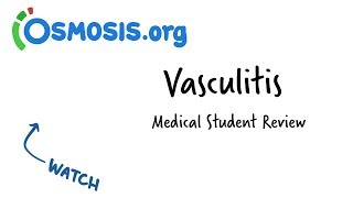 Vasculitis  Clinical Presentation [upl. by Kceb154]