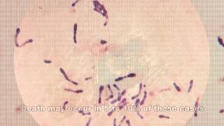 Corynebacterium diphtheriae amp Diphtheria [upl. by Annoved]