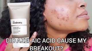 The Ordinary 10 Azelaic acid Suspension for Acne and Hyperpigmentation on Dark skin Review [upl. by Otreblanauj156]