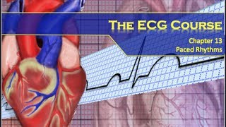 Electrocardiogram  Atrial amp Ventricular Hypertrophy [upl. by Eiramanig]