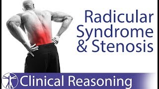 Lumbar Radicular Syndrome vs Intermittent Neurogenic ClaudicationStenosis [upl. by Garett]