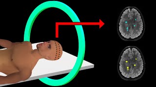 PET Scan  How It Works  Animation [upl. by Ollehcram789]