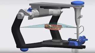 3Shape TRIOS Design Studio  Dynamic Virtual Articulator [upl. by Yerfej]