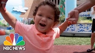 Baby Battles Painful Stone Man Syndrome  NBC News [upl. by Yoc402]