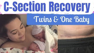 CSECTION RECOVERY TWINS amp BABY  CSection Recovery Tips  Postpartum Care  Mai Zimmy [upl. by Meaghan]