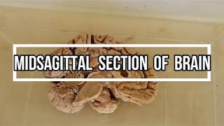 Midsagittal Section of Brain  neuroanatomy [upl. by Ahsurej]