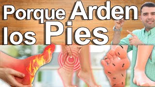 Porqué Me Arden Los Pies  Causas Y Soluciones Para El Ardor Y Dolor En Los Pies [upl. by Cirdet989]