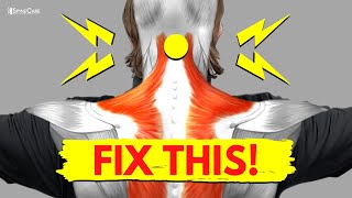 Neck Pain Relief Exercises in 5 min [upl. by Marianna]