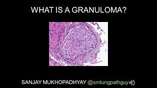 How to deal with Granuloma Annulare emotionally [upl. by Ja99]