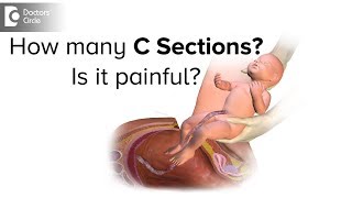 What is more painful C section or natural birthDr Mini Salunkhe of C9 Hospitals  Doctors’ Circle [upl. by Morril399]