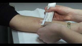 TB Skin Test  Mantoux Method [upl. by Waine340]