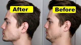 How To Get A Strong Chin And Jawline Lose Double Chin [upl. by Senzer]