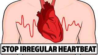 How to Fix your Irregular Heartbeat in Under 3 minutes [upl. by Courcy685]