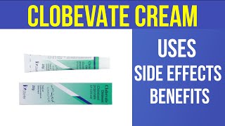 CLOBEVATE CREAM Uses Side Effect amp Benefits Urdu  Dr Review [upl. by Wernick]