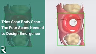 Trios Scan Body Scan  the four scans needed to design emergence [upl. by Edia]