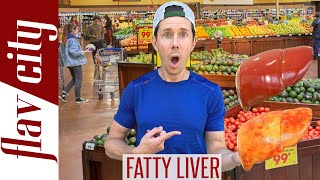 Top 10 Foods For Reversing FATTY LIVER DISEASEAnd What To Avoid [upl. by Sebastiano]