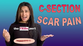 Dealing with CSection Scar Pain During Your Second Pregnancy Tips and Advice [upl. by Naitirb]