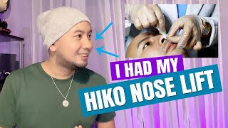 I Tried HIKO Nose Lift [upl. by Neeli]