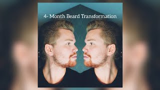 Beard Timelapse  4 Month Patchy Beard Growth [upl. by Noiz]