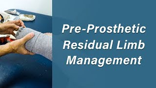 Residual Limb Management  Prosthetic Training Episode 1 [upl. by Neema921]