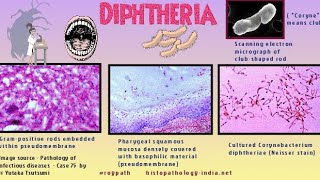 Corynebacterium diphtheriae Morphology and pathogenesis [upl. by Branch]