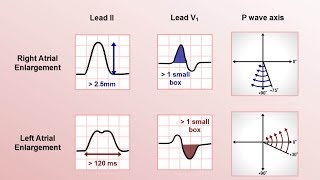 EKC ECG rhythms 1 Normal range of rhythms [upl. by Azeel825]