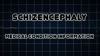 Schizencephaly Medical Condition [upl. by Johnsten345]