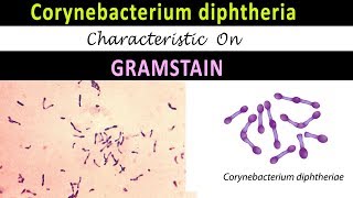 Corynebacterium Diphtheriae Characteristic on Gram Stain [upl. by Attenyt]