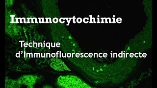 Méthode dimmunofluorescence indirecte [upl. by Sosthenna]