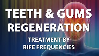 Teeth and Gums Regeneration Tooth  RIFE Frequencies Treatment  Energy amp Quantum Medicine [upl. by Trebleda]