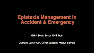 Emergency Epistaxis Management [upl. by Anatole214]