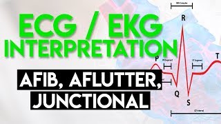 Afib Aflutter Junctional Arrhythmias  ECG EKG Interpretation Part 4 [upl. by Keefe635]