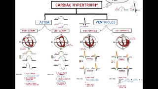 Ventricular Rhythms  EKG Interpretation  LevelUpRN [upl. by Gabriellia]