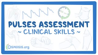 Clinical Skills Pulses assessment [upl. by Ahsie644]