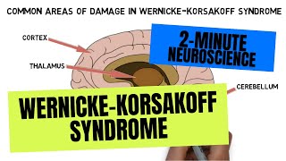 2Minute Neuroscience WernickeKorsakoff Syndrome [upl. by Leuname]