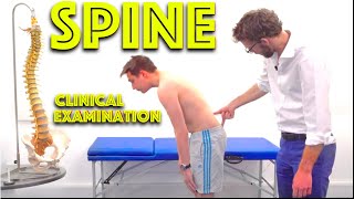 Spine Examination  Back Pain Assessment  4K  Clinical Skills  Dr Gill [upl. by Aihtenak161]