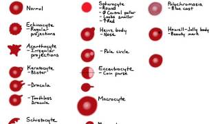 RBC Morphology [upl. by Thorma]