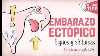 EMBARAZO ECTÓPICO 💔😭 Signos y síntomas [upl. by Maller]