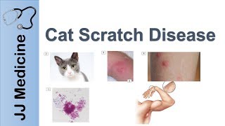 Cat Scratch Disease  Causes Symptoms and Treatment [upl. by Esej]