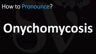 How to Pronounce Onychomycosis CORRECTLY [upl. by Gayel487]