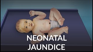 Neonatal Jaundice by L Veit  OPENPediatrics [upl. by Ynattirb913]