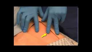 Anatomical Fascia Iliaca Compartment Block FICB Teaching Video [upl. by Honora187]