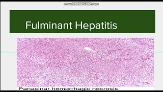 Fulminant Hepatitis Introduction Causes and Morphology [upl. by Nnaitsirhc]