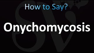 How to Pronounce Onychomycosis correctly [upl. by Elleira]