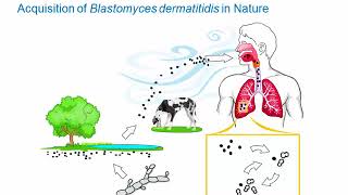 Dimorphic Fungi Blastomycosis Hot Topic [upl. by Huntingdon]